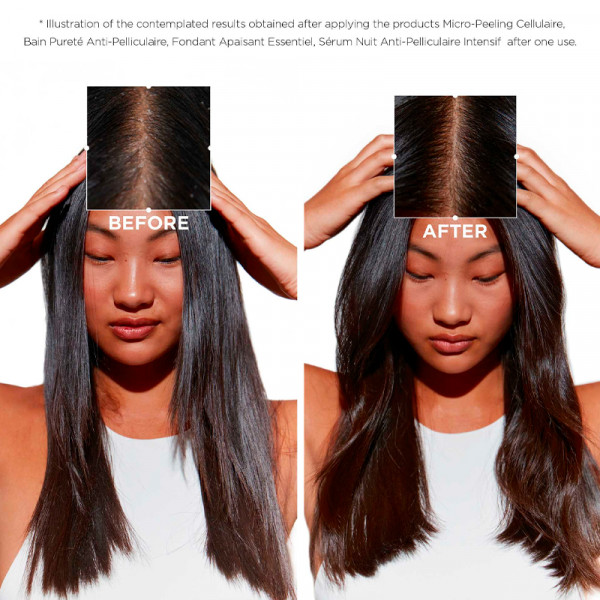 symbiose-bain-purete-anti-pelliculaire-shampoo-anticaspa