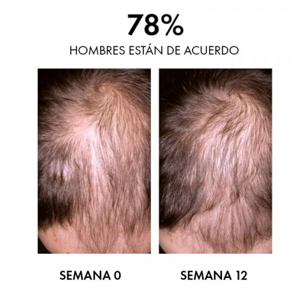 dercos-aminexil-clinical-regen-booster-haarserum