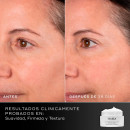 advanced-pro-collagen-peptide-cream-creme-hidratante-rejuvenescedor-antirrugas