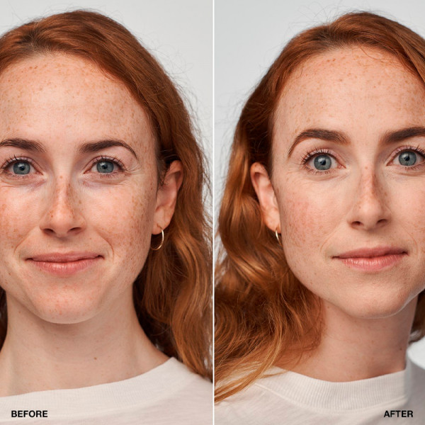 even-better-clinical-serum-foundation-broad-spectrum-spf25