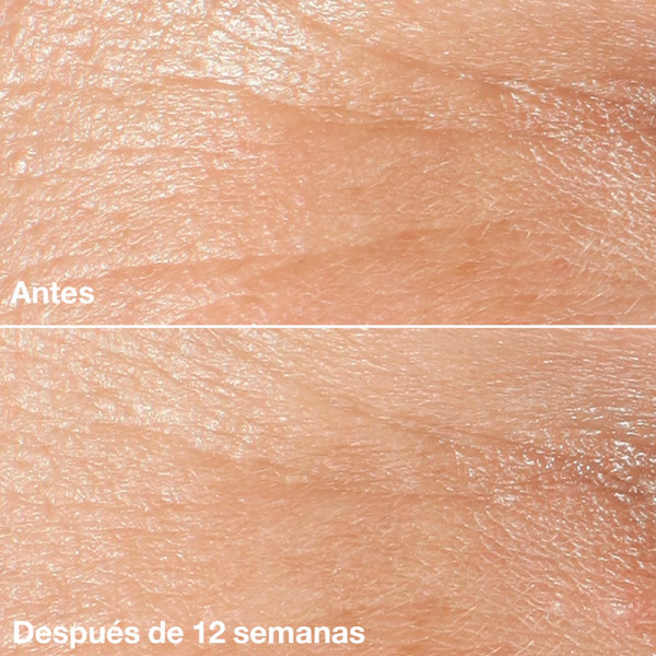 smart-clinical-repair-aterfuktande-kram-mot-rynkor