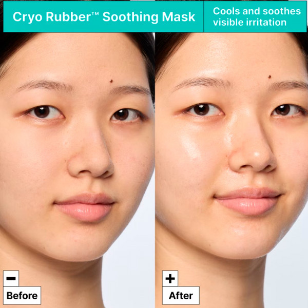 cryo-rubber-verzachtend-hydrogel-masker-verzachtend-gezichtsmasker