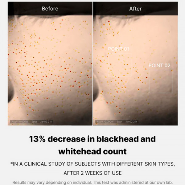 zero-pore-one-day-serum-serum-facial-esfoliante-limpador