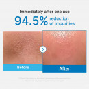 zero-pore-blackhead-deep-cleansing-oil-ansiktsrengoringsolja