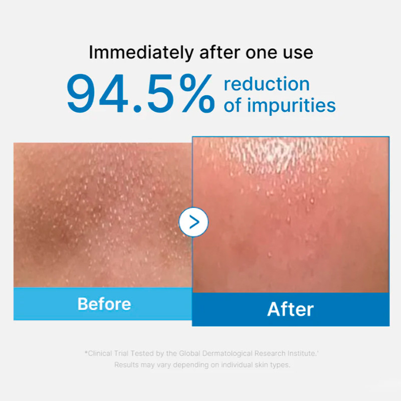Medicube Zero Pore Blackhead Deep Cleansing Oil Aceite Limpiador Facial – imagen 2