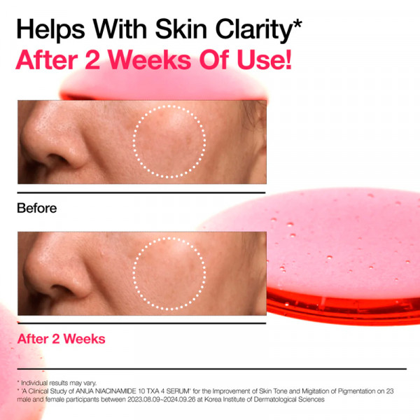 niacinamide-10-txa-4-serum-serum-intensif-anti-taches-et-eclat