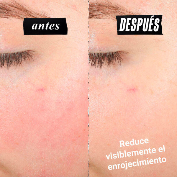 ultra-facial-meltdown-recovery-cream-moisturizing-facial-cream-for-sensitive-skin