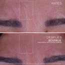 renergie-collagen-lift-xtend-facial-cream-with-collagen