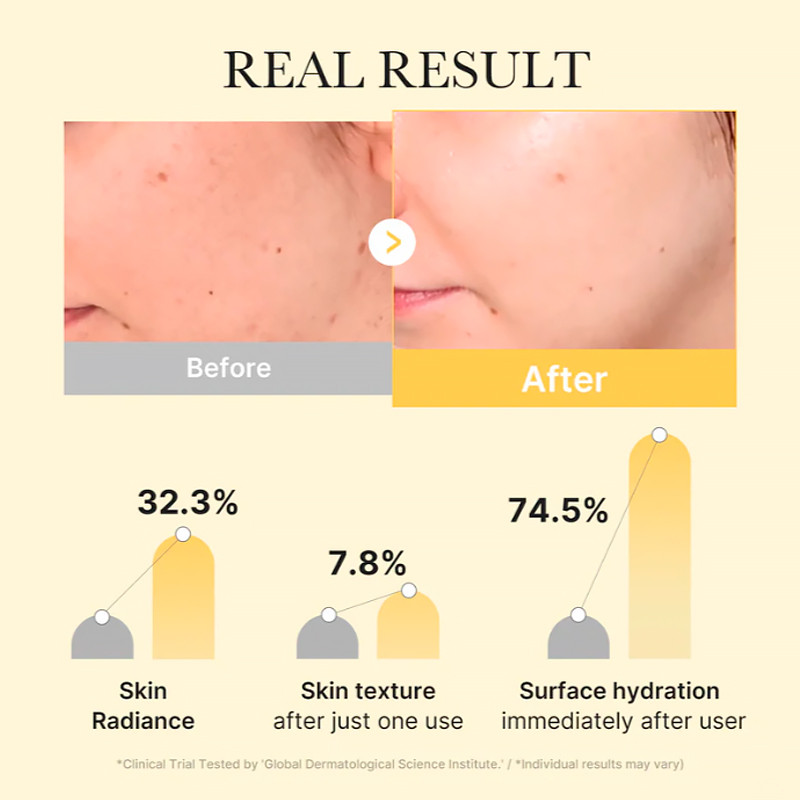 Medicube Kojic Acid Turmeric Gold Jelly Gel Mask Mascarilla Facial Iluminadora – imagen 3