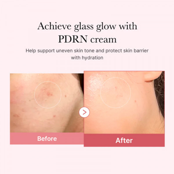 pdrn-pink-peptide-cream-crema-reparadora-reafirmante-facial