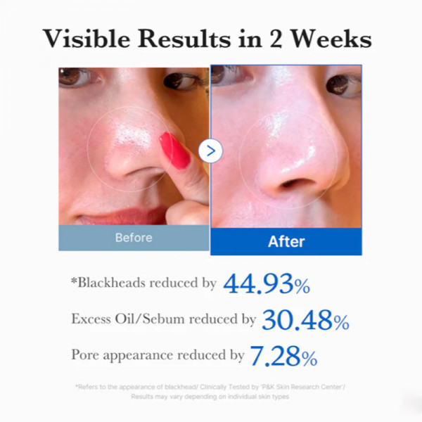 zero-pore-pads-dischi-esfolianti