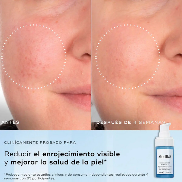 niacinamide-peptides-serum-with-10-niacinamide-with-peptides-and-nag
