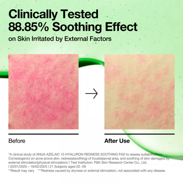 azelaic-10-hyaluron-redness-soothing-pad-soothing-facial-pads-redness