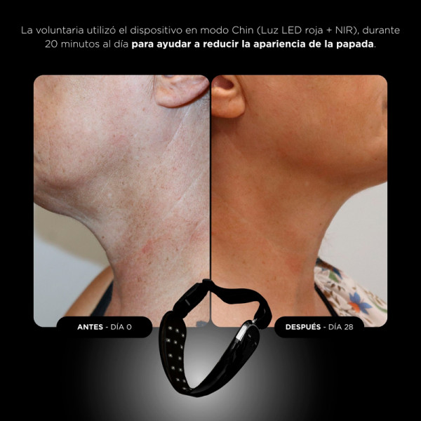 unicled-neck-chin-mask