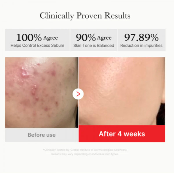 red-succinic-acid-panthenol-pads-disques-exfoliants-pour-le-visage