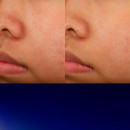 advanced-night-repair-recovery-treatment-essence-lekki-balsam-pielegnacyjny-nawilza-i-lagodzi