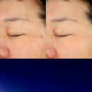 advanced-night-repair-recovery-treatment-essence-lekki-balsam-pielegnacyjny-nawilza-i-lagodzi
