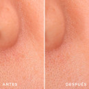 genifique-repair-shot-wrinkle-correcting-treatment