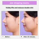 cryo-v-jawline-lifting-mask-lifting-effekt-maske