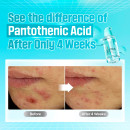 no1-pantothenic-b5-active-soothing-serum-beruhigendes-und-talgregulierendes-gesichtsserum