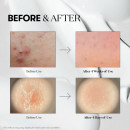 reedle-shot-300-soin-du-visage-regenerant-intensif