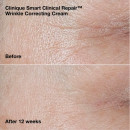 smart-wrinkle-correcting-routine-set