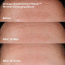 smart-wrinkle-correcting-routine-coffret