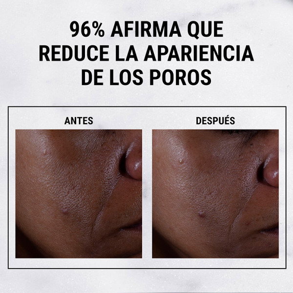 Serum Ácido Glicólico Ultra Pure High Potency