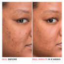 Bye Bye Dark Spots Niacinamide Serum