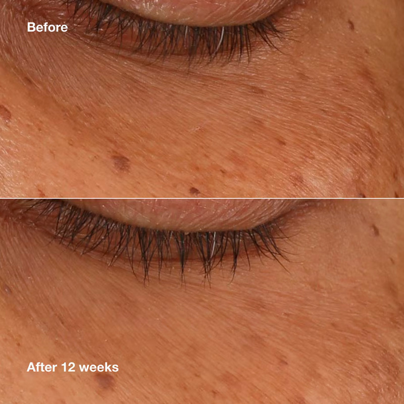 Clinique All About Eyes Brightening Serum Sérum Contorno De Ojos – imagen 3