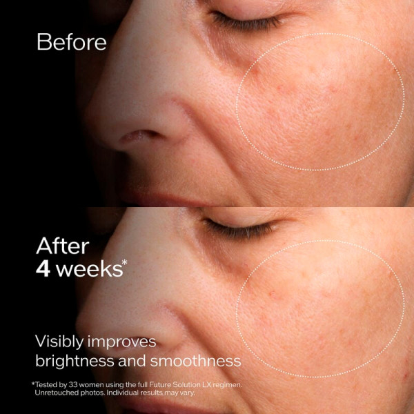 future-solution-lx-concentrated-brightening-softener-lotion-equilibrante-hydratante