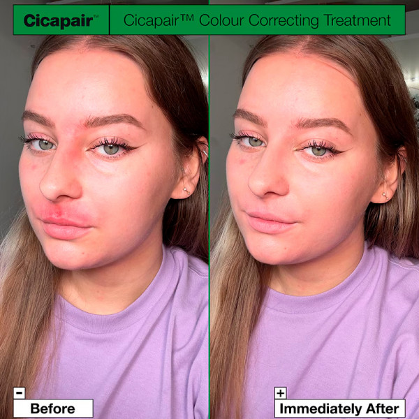 tiger-grass-color-correcting-treatment-leczenie-korekcyjne