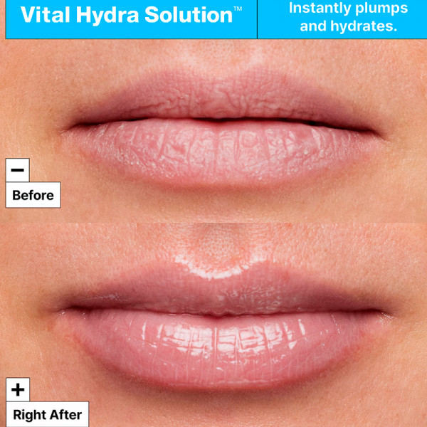 hydra-solution-lip-mask-mascarilla-labial