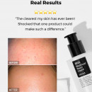 bha-blackhead-power-liquid-tratamiento-puntos-negros-e-imperfecciones