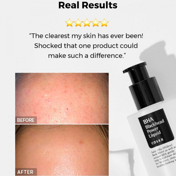 bha-blackhead-power-liquid-blackhead-and-imperfection-treatment