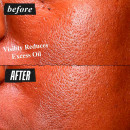 serum-niacinamida-ultra-pure-high-potency