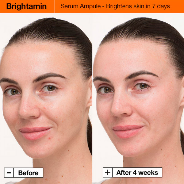 brightamin-brightening-serum-serum-med-niacinamid-og-c-vitamin
