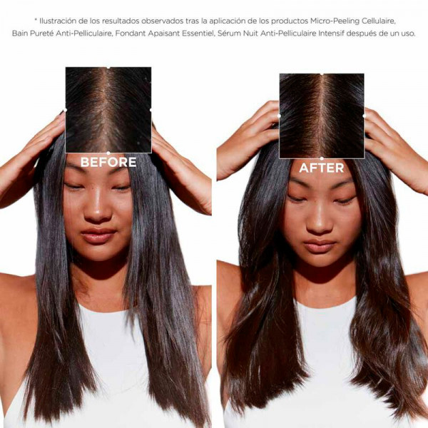 serum-cellulaire-nuit-anti-pelliculaire-intensif-anti-dandruff-treatment